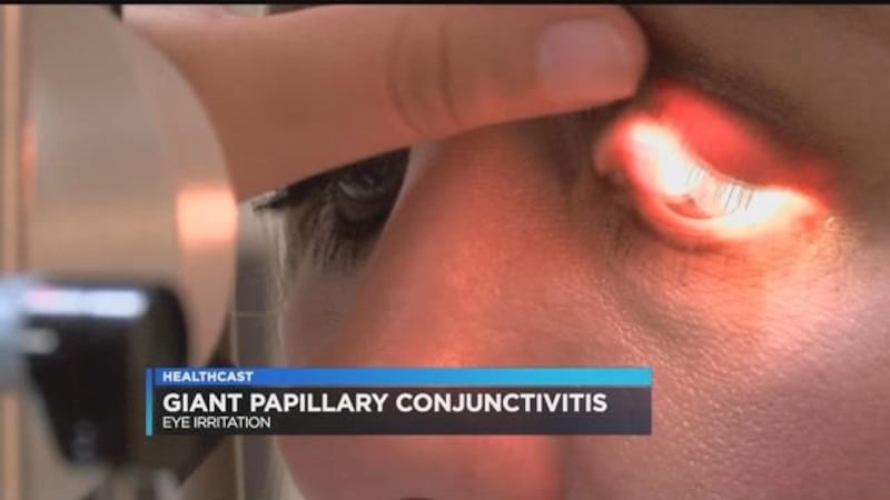Vision Source associate optometrist, Dr. Madison Wall-Hayes, says she is seeing more cases of...