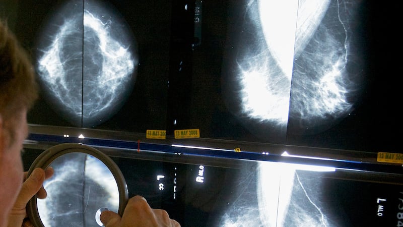 Un radiólogo utiliza una lupa para revisar mamografías en busca de cáncer de mama en Los...