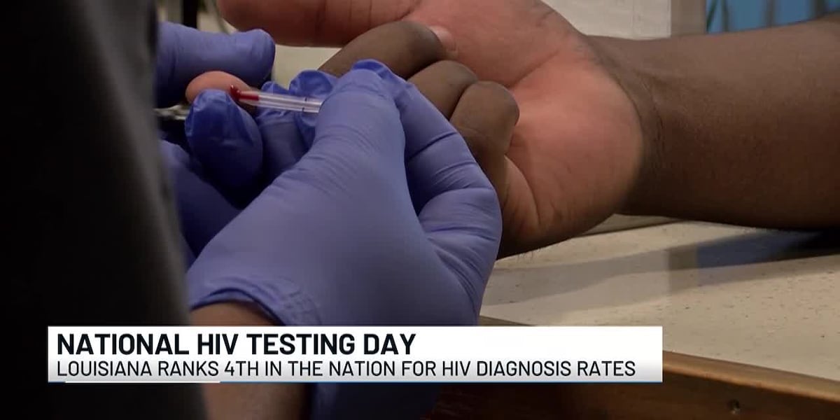 Doctors warn that HIV still runs rampant across Louisiana