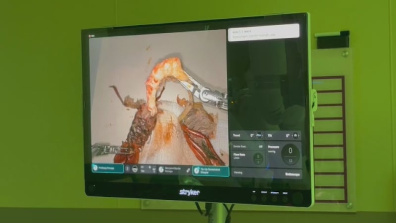 Shelling gets surgical: Surgeon shows precision of medical robot by peeling boiled crawfish