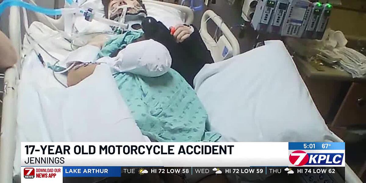 Teen’s quick thinking may have saved his life in motorcycle crash